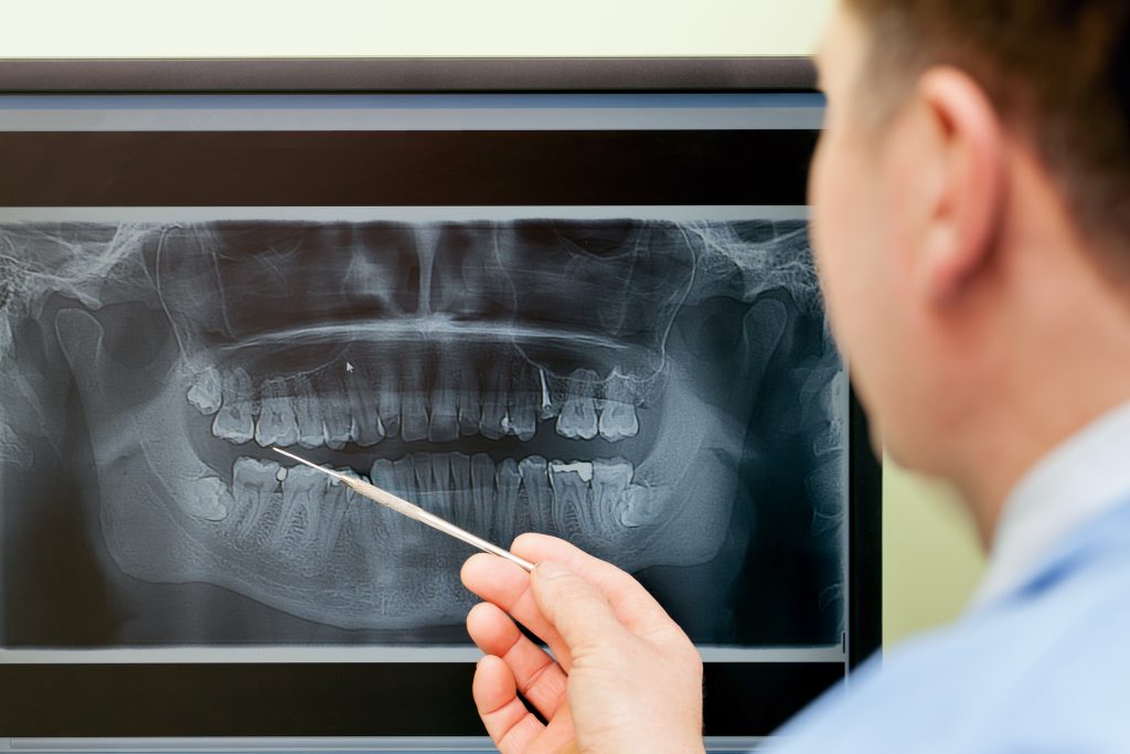 dentist pointing at an x-ray prior to oral & maxillofacial surgery